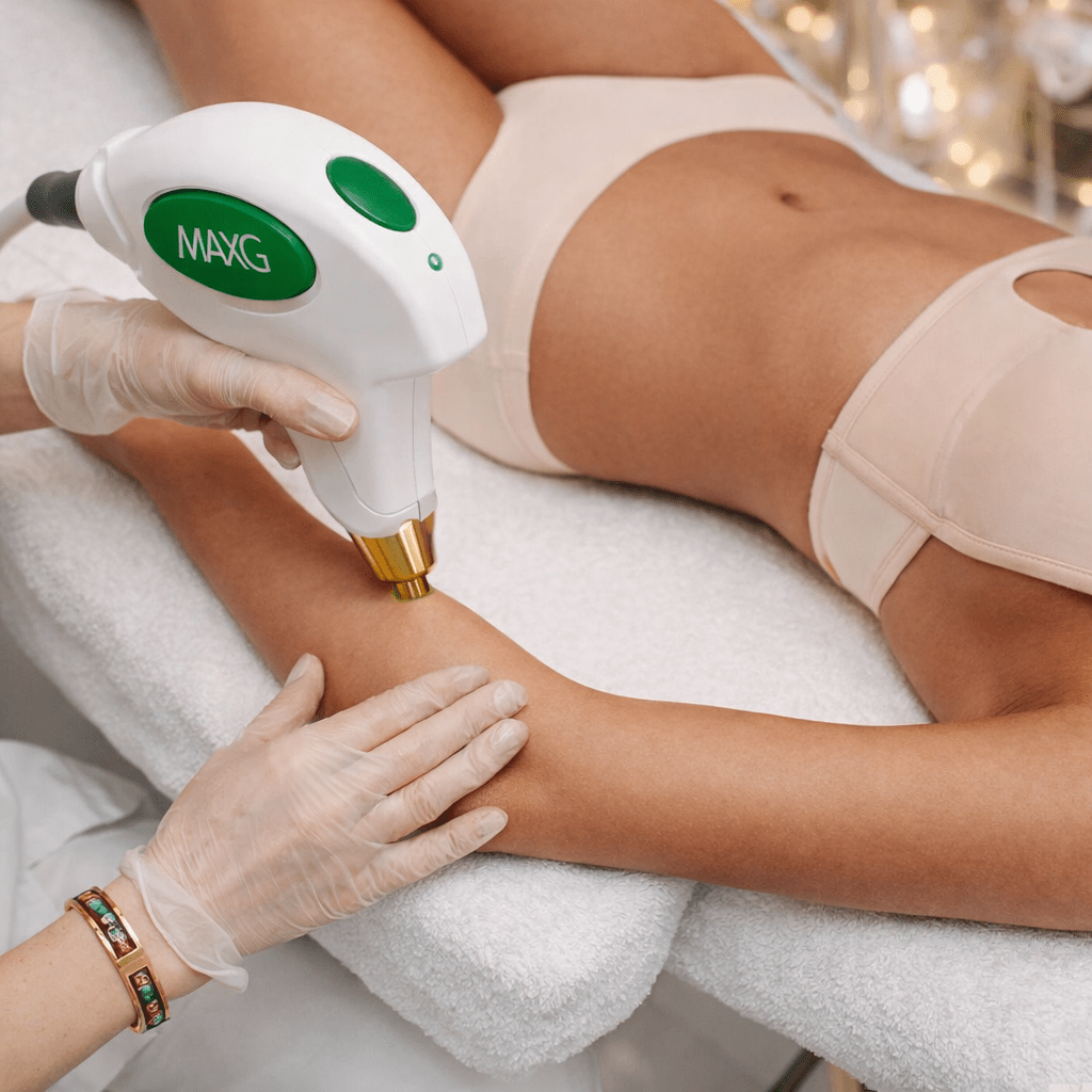 Photofacial - Arms - Allure Aesthetics