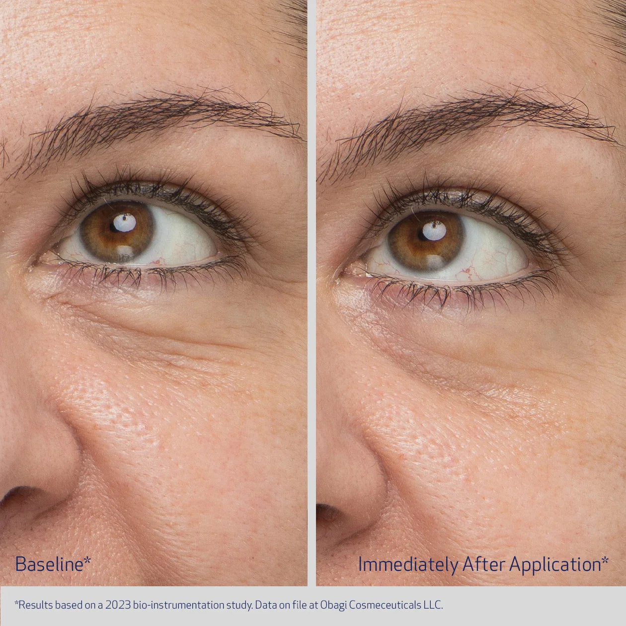 Obagi Daily Hydro-Drops® Rejuvenating Eye Gel Cream