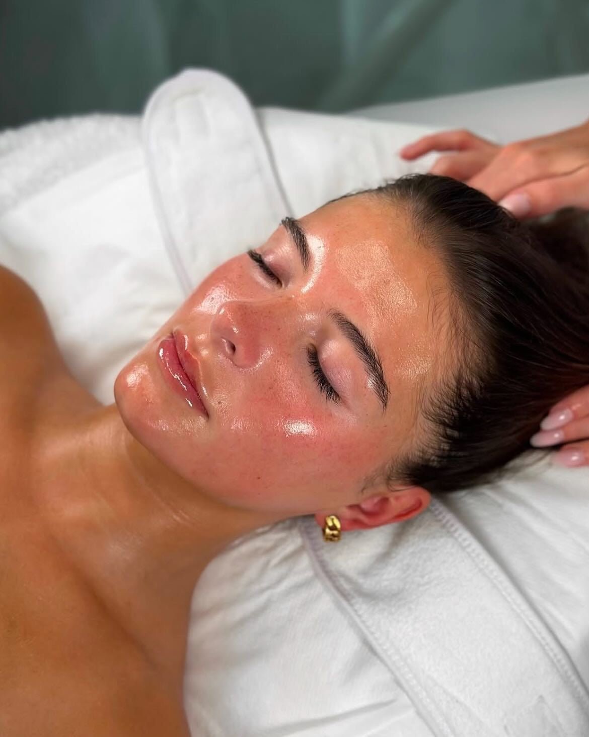 Classic HydraFacial MD - Allure Aesthetics