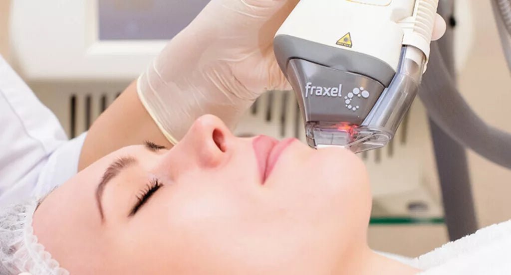 Fraxel - Spot Treatment - Allure Aesthetics