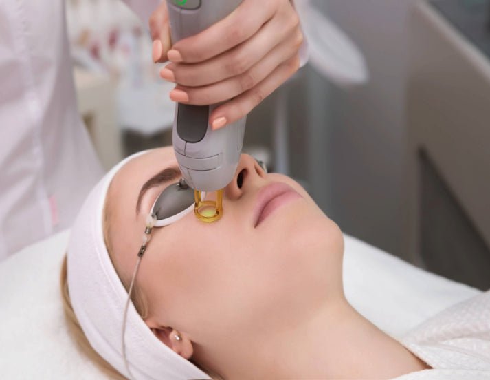 Laser Vein Treatment - Small Area - Allure Aesthetics