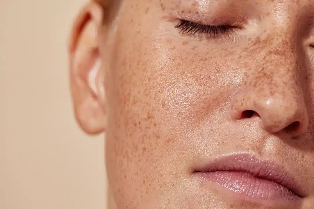 Light & Bright - Face - Allure Aesthetics