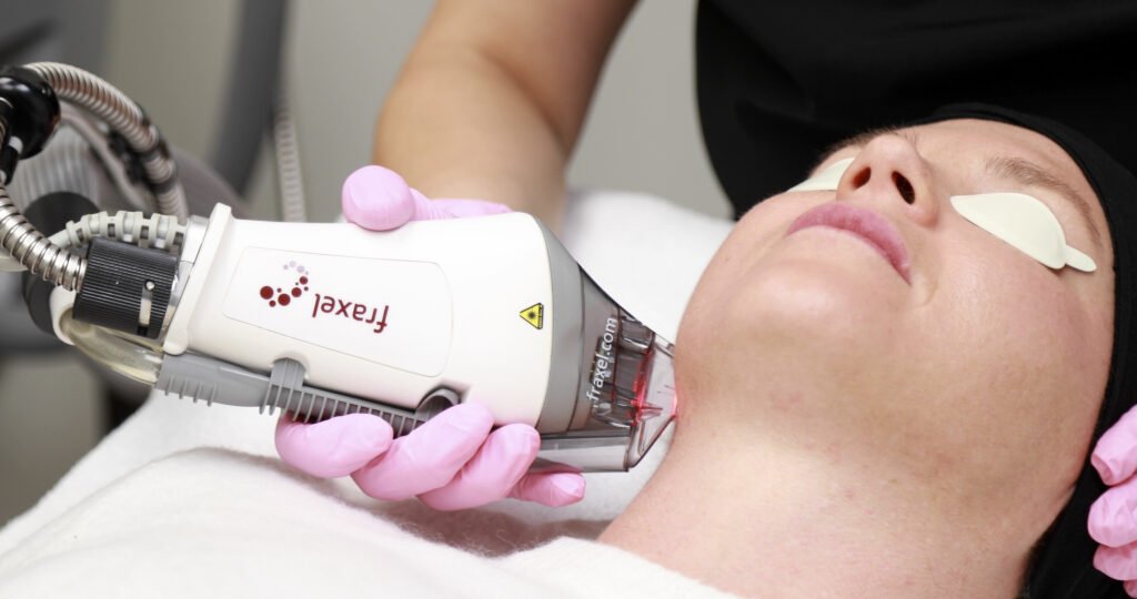 Neck Fraxel Package of 6 - Allure Aesthetics