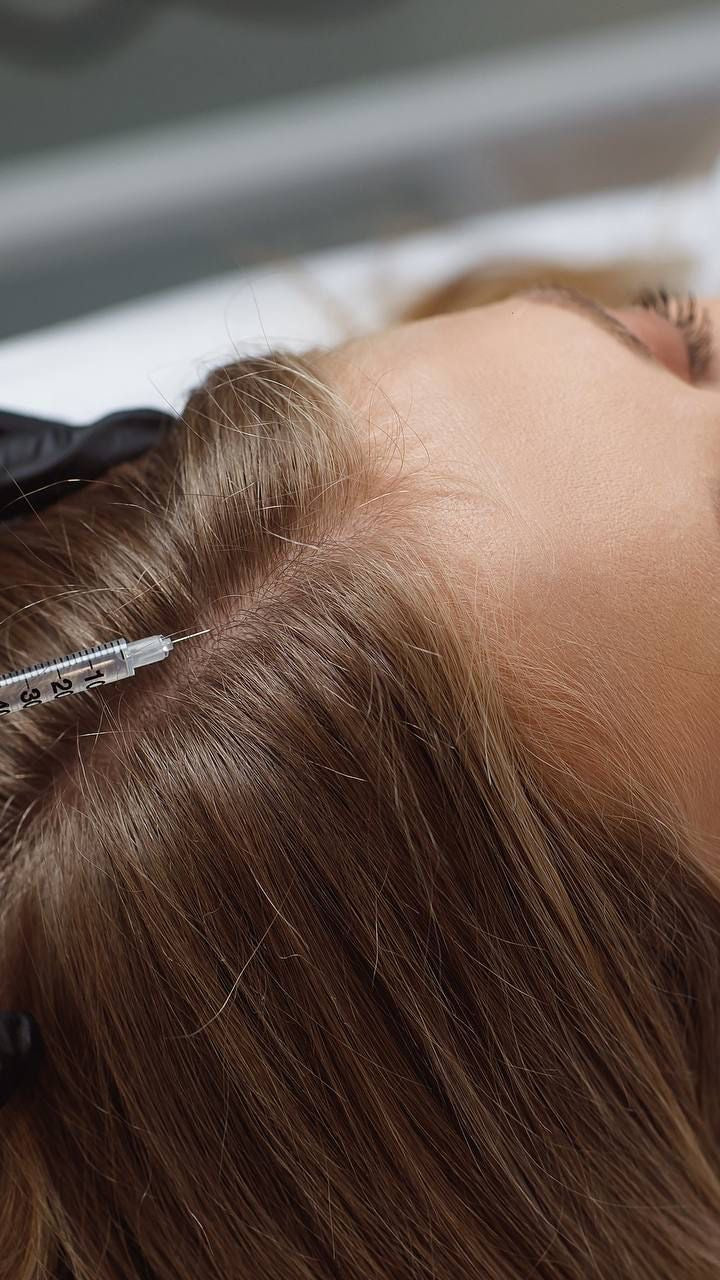 Scalp Tox - Allure Aesthetics
