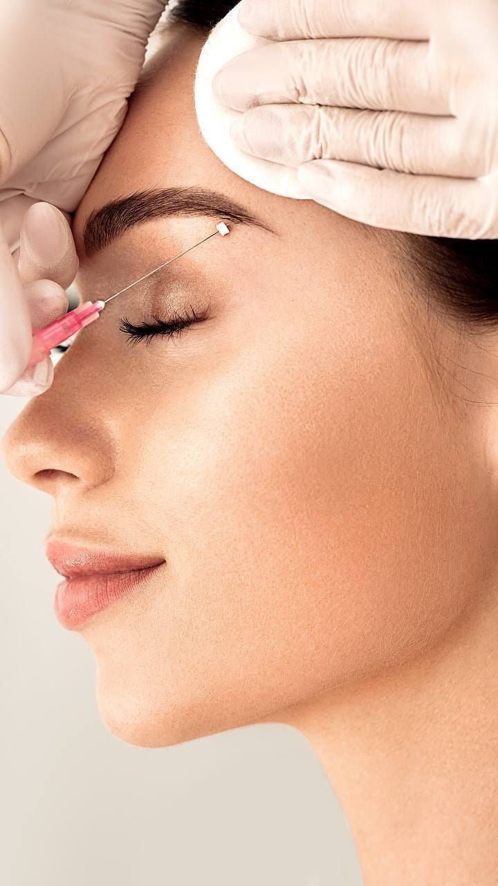 Thread Lift - Allure Aesthetics