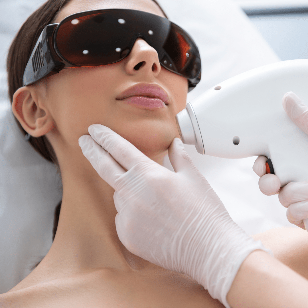 Laser Hair Removal - Chin - Allure Aesthetics
