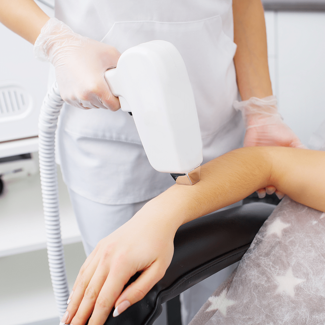 Laser Hair Removal - Full Arms - Allure Aesthetics